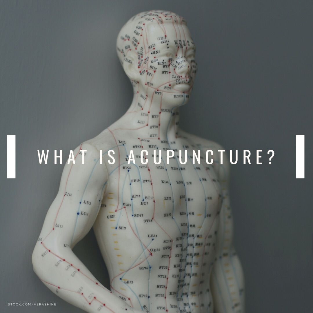 Acupuncture - ProviStar Acupuncture